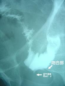 再建後の写真4