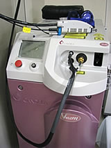 Vbeam
