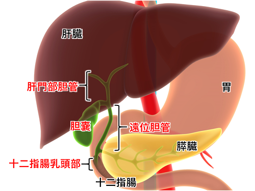 十二指腸 腫瘍