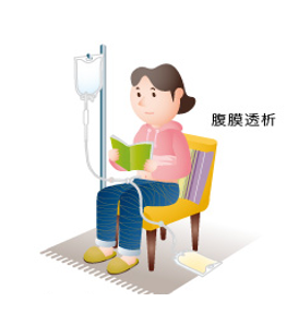 腹膜透析のイメージ図