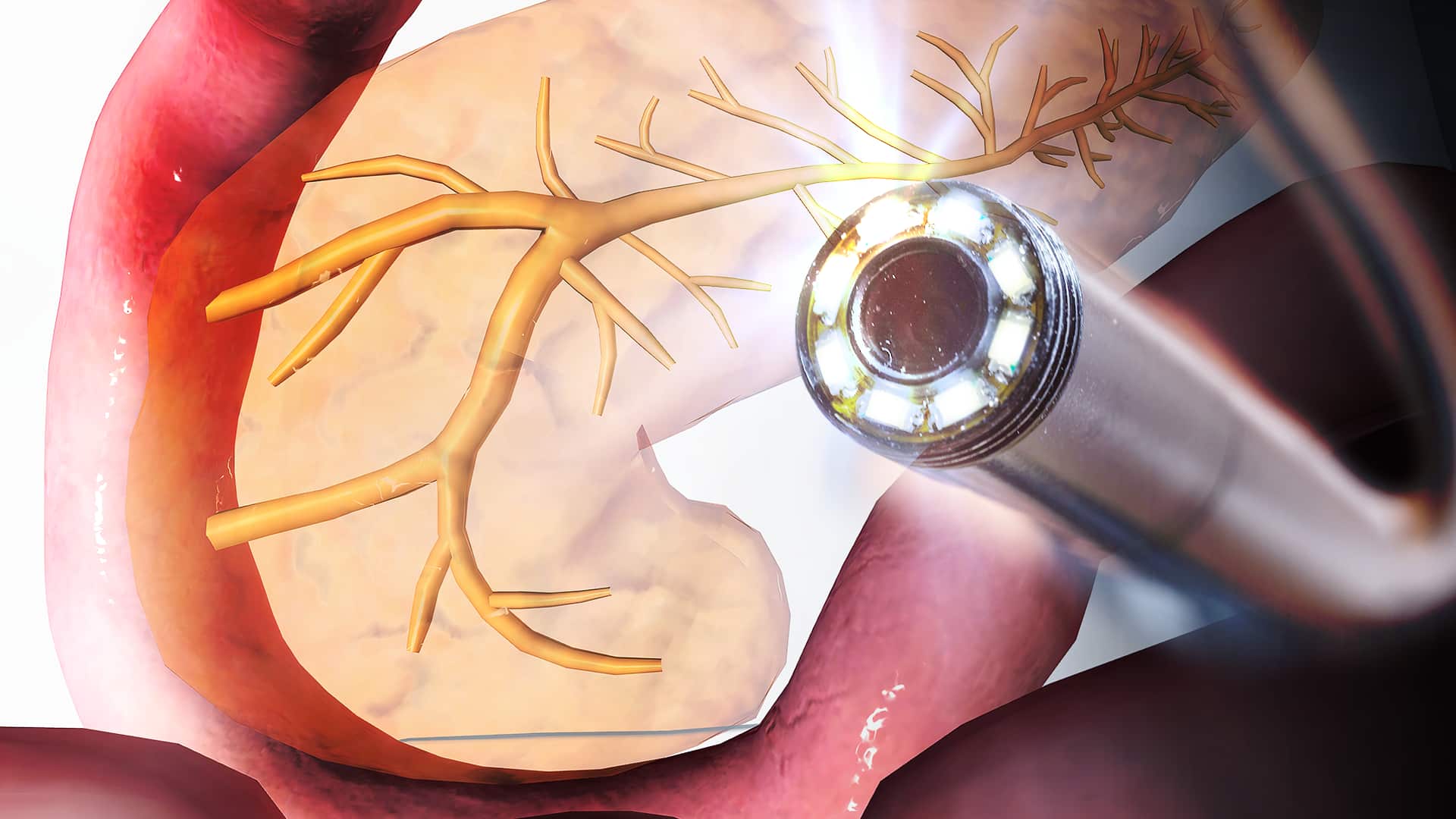 膵臓と内視鏡イメージ図