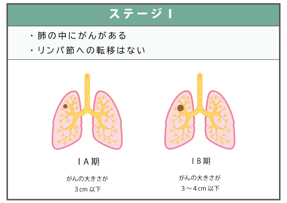ステージⅠの肺がんイメージ
