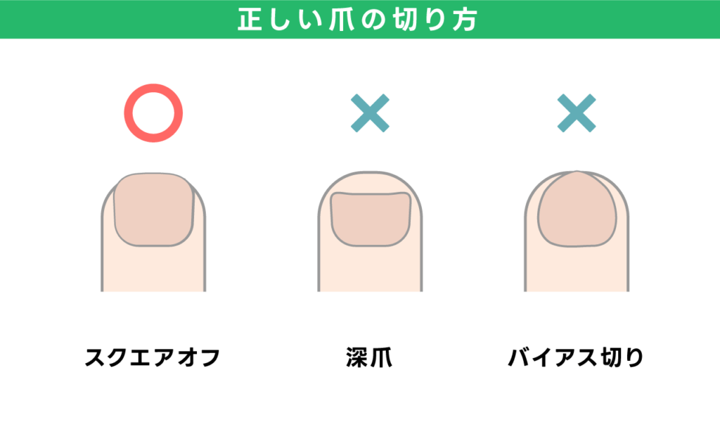 正しい爪の切り方 〇　スクエアオフ ×　深爪 ×　バイアス切り
