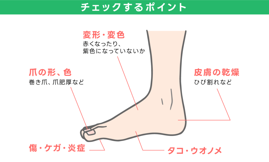 チェックをするポイント 変形・変色　爪の形、色　皮膚の乾燥　傷・ケガ・炎症　タコ・ウオノメ