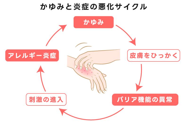 かゆみと炎症の悪化サイクルのイメージ図