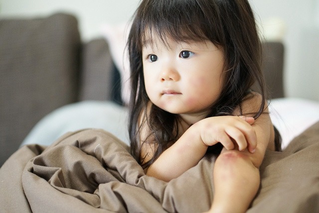 かゆみをもつ子どものイメージ写真